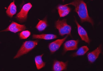 Anti-RPL32 Antibody