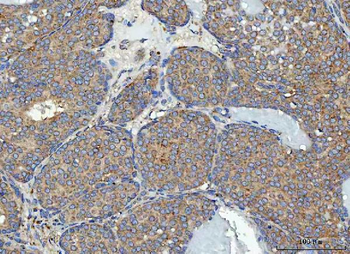 Anti-RPL32 Antibody