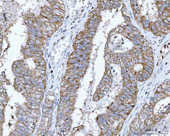Anti-RPL32 Antibody
