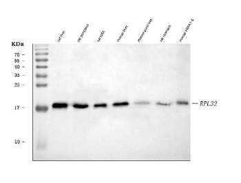 Anti-RPL32 Antibody