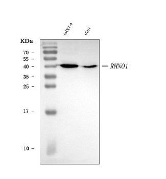 Anti-RHNO1 Antibody