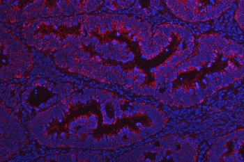 Anti-NDUFV2 Antibody