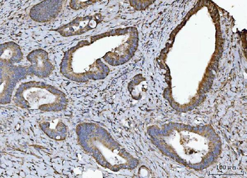 Anti-NDUFV2 Antibody