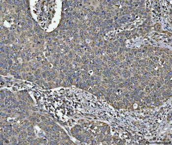 Anti-NDUFV2 Antibody