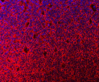 Anti-MTHFD1 Antibody