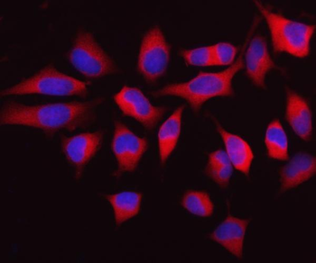 Anti-MTHFD1 Antibody