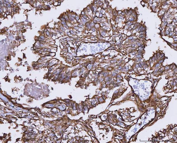 Anti-MTHFD1 Antibody