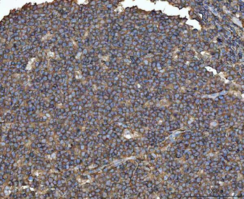 Anti-MTHFD1 Antibody