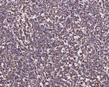 Anti-MTHFD1 Antibody