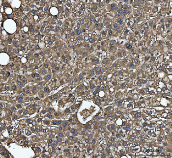 Anti-MTHFD1 Antibody