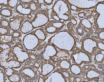 Anti-MTHFD1 Antibody
