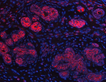 Anti-IMPDH2 Antibody
