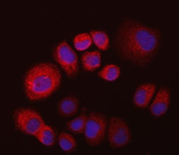Anti-IMPDH2 Antibody