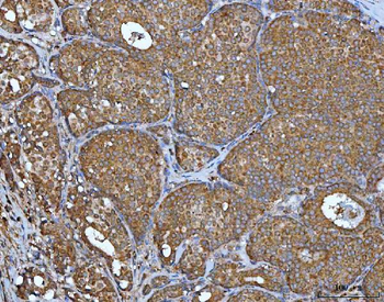 Anti-IMPDH2 Antibody