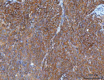Anti-IMPDH2 Antibody