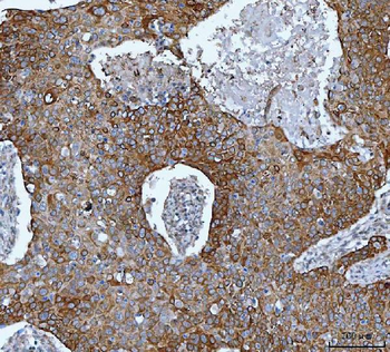 Anti-IMPDH2 Antibody