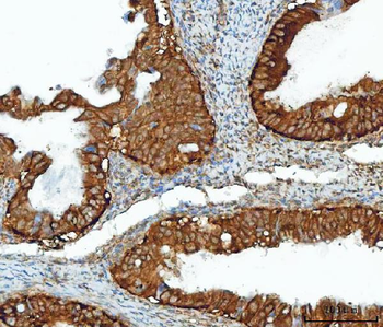 Anti-IMPDH2 Antibody