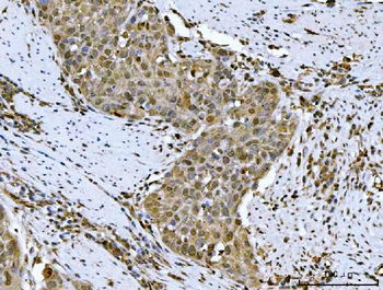 Anti-HSF1 Antibody
