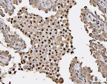 Anti-HSF1 Antibody
