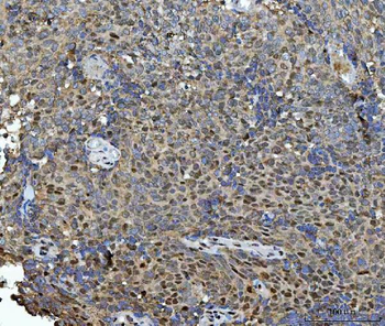 Anti-HSF1 Antibody