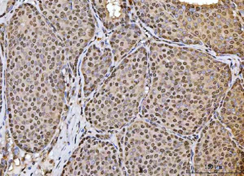 HOXC4 Antibody