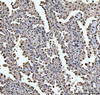 HOXC4 Antibody