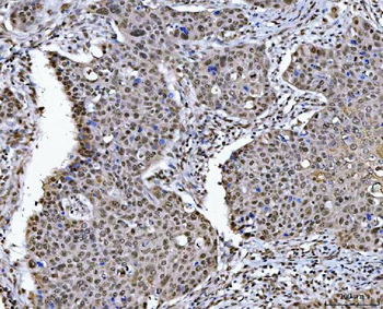 Anti-HDAC1 Antibody
