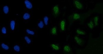 Anti-GLIS1 Antibody