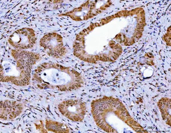 Anti-GLIS1 Antibody