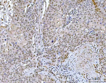 Anti-GLIS1 Antibody