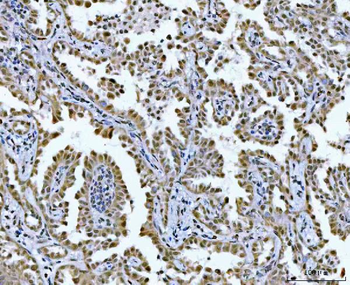 Anti-GLIS1 Antibody