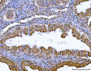 Anti-GLIS1 Antibody