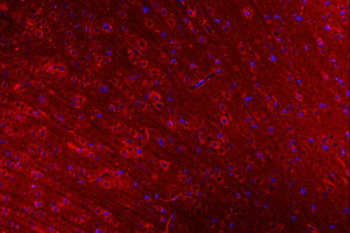 Anti-CLASP1 Antibody