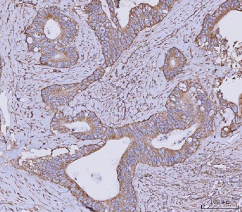 Anti-CLASP1 Antibody