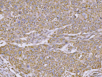 Anti-CLASP1 Antibody