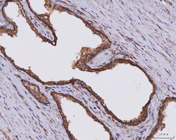 Anti-CLASP1 Antibody