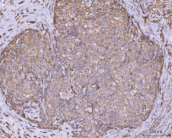 Anti-CLASP1 Antibody