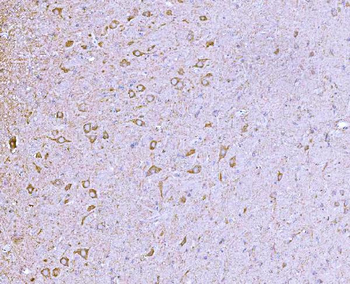 Anti-CLASP1 Antibody