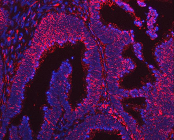 Anti-ARL1 Antibody