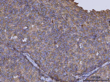 Anti-ARL1 Antibody