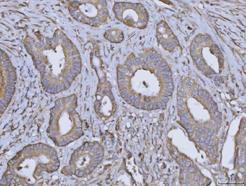 Anti-ARL1 Antibody