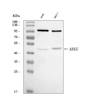Anti-Amphiregulin/AREG Antibody