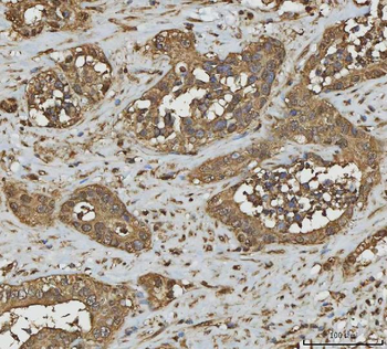 Anti-Annexin A10/ANXA10 Antibody