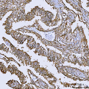 Anti-Annexin A10/ANXA10 Antibody