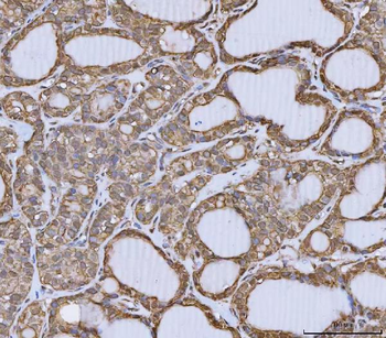 Anti-Annexin A10/ANXA10 Antibody
