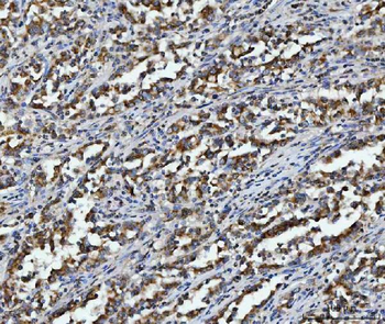 Anti-Aconitase 2 Antibody (monoclonal, 4C12D1)
