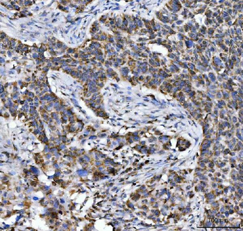 Anti-Aconitase 2 Antibody (monoclonal, 4C12D1)