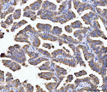 Anti-Aconitase 2 Antibody (monoclonal, 4C12D1)