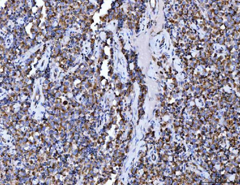 Anti-Aconitase 2 Antibody (monoclonal, 4C12D1)
