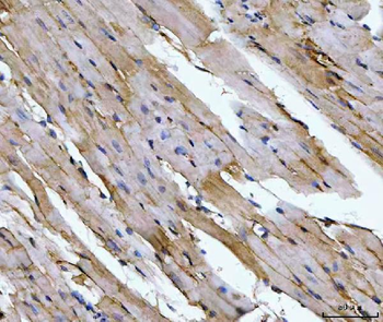 Anti-Aconitase 2 Antibody (monoclonal, 4C12D1)